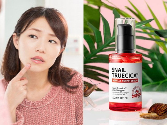 Top 6 sản phẩm trị mụn hiệu quả được phụ nữ Hàn yêu thích