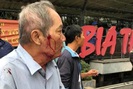 Hà Nội: Điều tra vụ cụ ông 80 tuổi chạy xe ôm bị đánh đến nhập viện