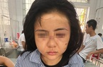 Cô gái bị hành hung suốt 2 giờ tại Yên Bái: Công an nói gì?