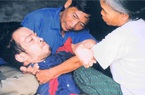 Ảnh: 60 năm nhìn lại "nỗi đau da cam" qua triển lãm đặc biệt