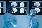 Các bác sĩ Anh cảnh báo về 'cuộc khủng hoảng ung thư lớn nhất'
