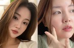 6 cách ngăn ngừa mụn trong dịp Tết