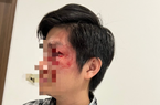 Vụ người đàn ông bị đấm rách mí mắt, vỡ răng ở chung cư vì... ngăn chó thả rông: Chủ chó nói gì?