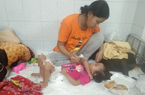 Bé gái bị bỏng nặng ở Bắc Kạn đang chuyển biến tích cực