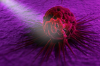 Hạt Nano: Vũ khí mới chống lại ung thư