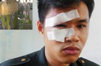 Quảng Ngãi: Khởi tố 9 đối tượng quá khích chặn xe trên QL1