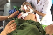 Bệnh dại - hiểm họa rình rập trẻ nhỏ