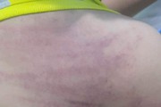 Một nữ nội trợ mở lớp dạy thêm, đánh bầm dập trò lớp 5 ở Phú Yên