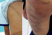 Vụ mẹ kế đánh con chồng bằng roi tre: Khởi tố vụ án