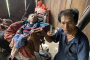 Xót xa cảnh éo le của gia đình người Mông xã vùng cao Tả Ngảo: 3 người bị liệt, 1 người "ngẩn ngơ"...