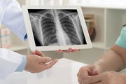 Nhập viện do tự ý điều trị viêm phổi, bác sĩ cảnh báo thói quen nhiều người thường mắc