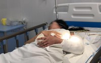 Vụ xe lao xuống vực: Phẫu thuật nối tay nữ sinh khó như thế nào?