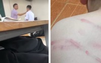 Liên tiếp các vụ giáo viên bạo hành học sinh: "Sỉ nhục học sinh thể hiện sự kém cỏi của người thầy"