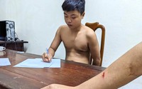 Quảng Nam: Bắt thanh niên dùng xà beng tấn công làm đại úy công an bị thương
