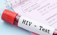  Điều kiện xác định người bị nhiễm HIV do tai nạn rủi ro nghề nghiệp