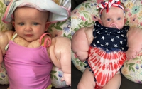 Mỹ: Bé gái 9 tháng tuổi có cơ bắp như siêu anh hùng do mắc căn bệnh hiếm