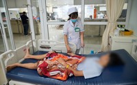 Kiên Giang: Một học sinh lớp 9 bị nhóm người đánh trọng thương, vỡ lách