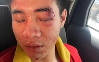 Nam nhân viên của một nhà xe ở Hà Nội bị nhóm người hành hung