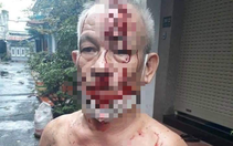 TP.HCM: Thực hư "người đàn ông thắc mắc tiền trợ cấp, bị ném gạch vào đầu" ở quận Tân Phú