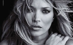 Siêu mẫu Kate Moss bất ngờ bị liệt tay phải