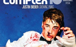 &#34;Chiến&#34; với võ sĩ, Justin Bieber bị đấm tóe máu