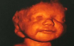 Định phá thai thì thấy con mỉm cười