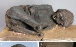 Kinh hoàng xác ướp người Inca bị tra tấn nát sọ