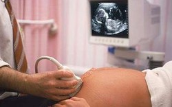 Vì sao bà bầu không nên ghi hình siêu âm thai nhi làm kỉ niệm?
