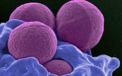 Số người chết vì siêu vi khuẩn sẽ vượt ung thư