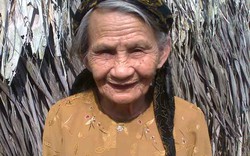 Cụ bà 82 tuổi bị ong đốt hơn 100 nốt vẫn sống