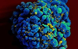 Đã tìm ra vắc-xin phòng HIV?