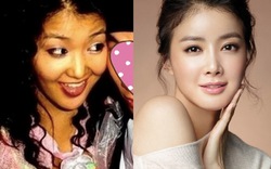 10 mỹ nam, mỹ nữ Hàn Quốc thừa nhận từng 'dao kéo'