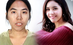 Cô gái Thái Lan răng hô 'lột xác' bất ngờ nhờ thẩm mỹ