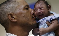 Hé lộ những sự thật khủng khiếp về virus "ăn não" Zika