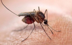 Dấu hiệu nhận biết cơ thể đang mắc virus Zika