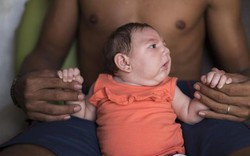 Colombia: 3 ca tử vong đầu tiên sau khi nhiễm virus Zika