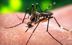 5.000 phụ nữ Colombia mang thai mắc virus Zika