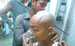 Ấn Độ: Thanh sắt 2m xuyên đầu không chết