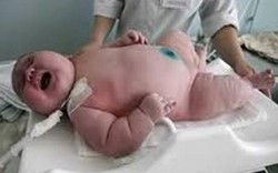 5 bé sơ sinh "khổng lồ" nhất thế giới