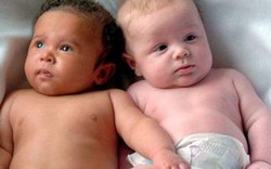 Những ca sinh đôi, sinh ba "mỗi con một bố khác nhau"