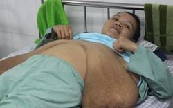 Người đàn bà có "ngực dài quá rốn": Nhờ mẹ nuôi hộ con vì sợ chết vì bệnh lạ