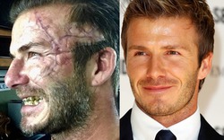 David Beckham gây sốc với diện mạo "xấu đau đớn"