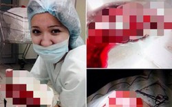 Nữ y tá Nga chơi đùa với nội tạng bệnh nhân gây phẫn nộ