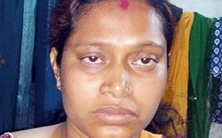 Ấn Độ: Chồng cắt trộm thận, 2 năm sau vợ mới biết