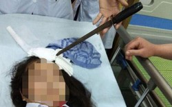 Nóng 24h qua: Nữ sinh nhập viện với cây dao cắm thẳng trên trán