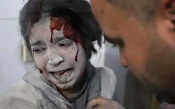 Tin thế giới: Địa ngục Đông Ghouta, Syria ngày thứ 7 đẫm máu