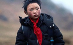 Cậu bé tóc đóng băng ở Trung Quốc 'khổ vẫn hoàn khổ'