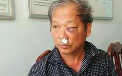 Vụ phóng viên VTV bị đánh: Tạm giữ một đối tượng