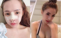 Đẹp như tiên, hot girl thẩm mỹ Sài Gòn tiếp tục sửa mũi bất chấp nguy hiểm