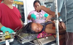 Philippines: Con bị cá sấu lôi xuống nước cắn, cha liền nhảy xuống cắn lại
